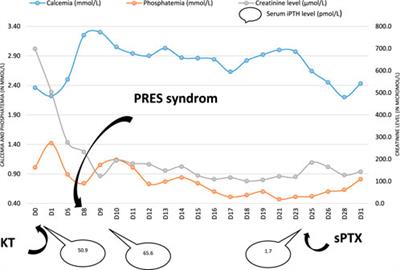 Acute and Severe Hypercalcemia Early After Kidney Transplantation in a Patient Previously Treated With Etelcalcetide